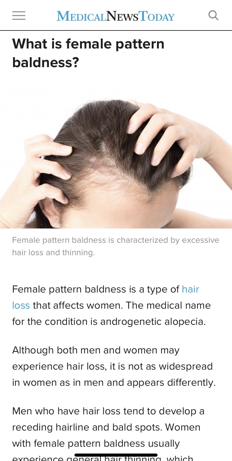 Thuốc rụng tóc Finasteride trị rụng tóc có gây yếu sinh lý nam giới không