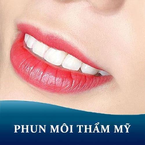 phun-moi-tham-my