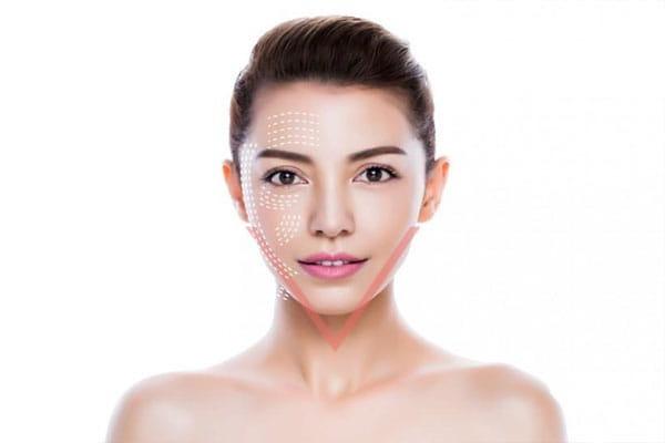 Khái niệm về phương pháp làm đẹp căng da mặt bằng chỉ Collagen