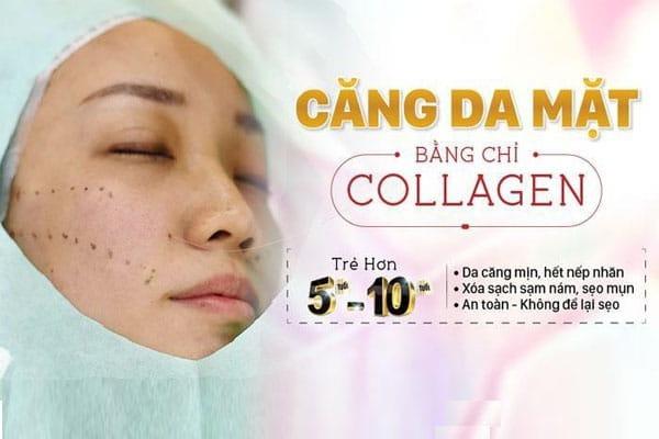Nâng cơ căng da mặt bằng chỉ collagen có tốt không?