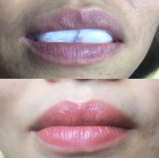 Sự khác biệt của môi trước và sau khi phủ bóng collagen