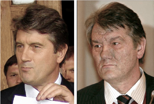 https://cdn.noron.vn/2022/03/11/president-viktor-yushchenko-of-ukraine-before-and-after-dioxin-poisoning-with-1646979128.png