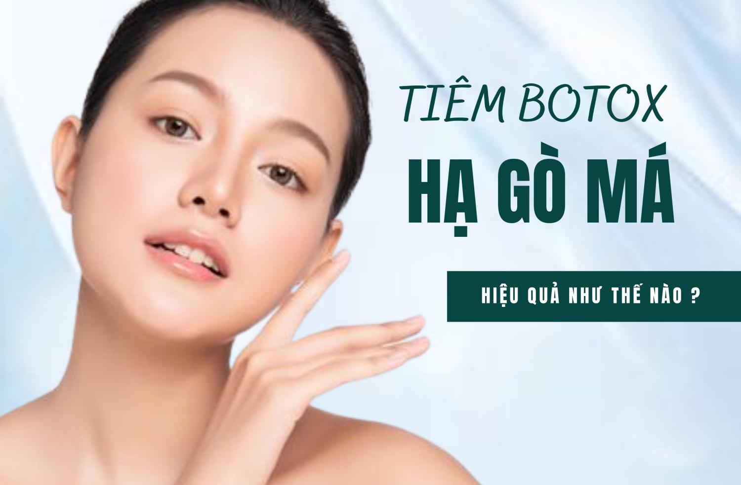 Tiêm hạ gò má