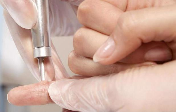 Loại bỏ mụn cóc phẳng bằng laser